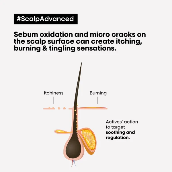 L'Oréal Professionnel  Scalp Advanced Anti-Discomfort Intense Soother Treatment - Image 5
